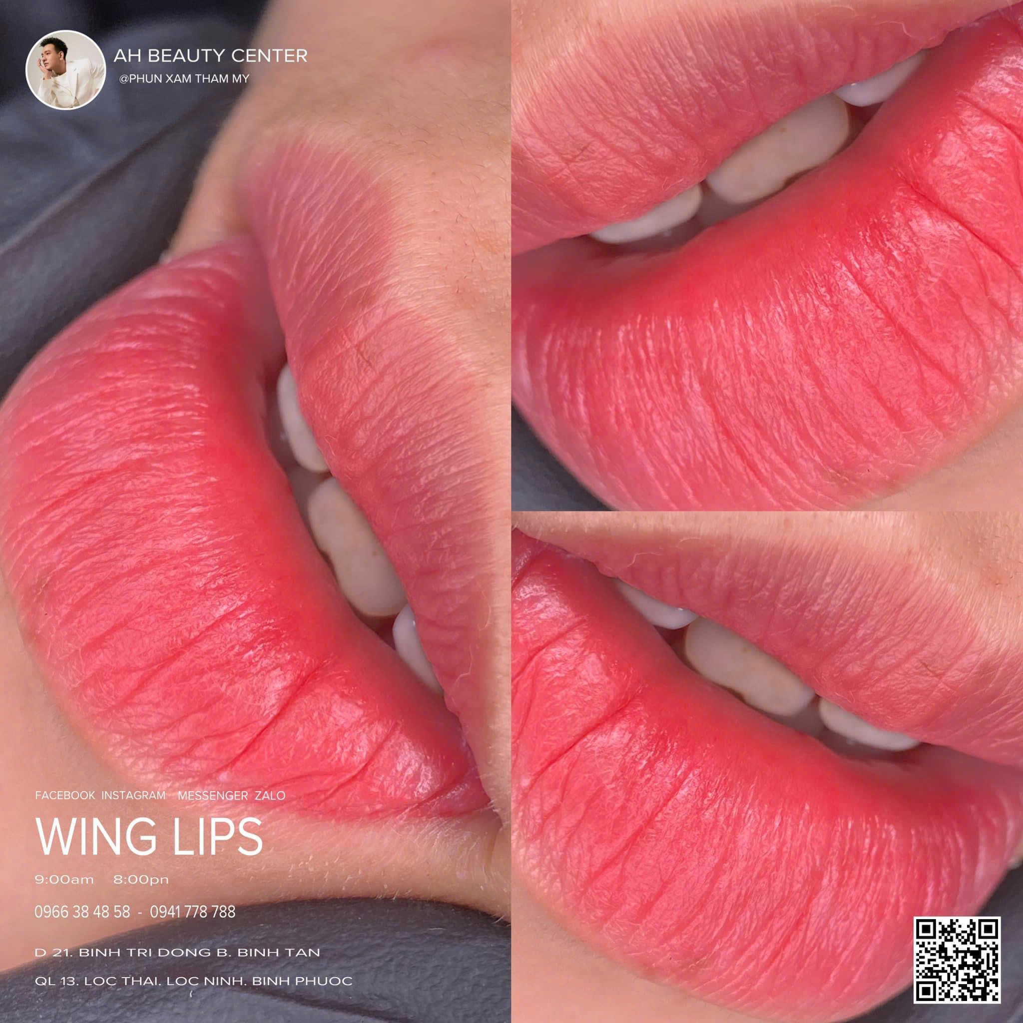 WINGS LIPS